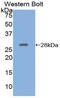 Adenylate cyclase type 5 antibody, LS-C292644, Lifespan Biosciences, Western Blot image 