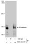 Cadherin 1 antibody, PA5-32178, Invitrogen Antibodies, Immunoprecipitation image 