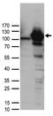 Probable ATP-dependent RNA helicase DDX58 antibody, TA890033, Origene, Western Blot image 
