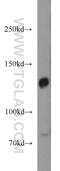 Protocadherin 11 X-Linked antibody, 20070-1-AP, Proteintech Group, Western Blot image 