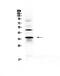 CD40 Ligand antibody, PA5-78983, Invitrogen Antibodies, Western Blot image 