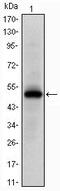 EPH Receptor A10 antibody, MA5-15848, Invitrogen Antibodies, Western Blot image 