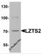 Leucine Zipper Tumor Suppressor 2 antibody, 6635, ProSci Inc, Western Blot image 
