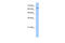 Solute carrier family 22 member 11 antibody, ARP43993_T100, Aviva Systems Biology, Western Blot image 