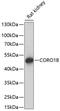 Coronin 1B antibody, GTX66270, GeneTex, Western Blot image 