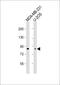 SMAD Specific E3 Ubiquitin Protein Ligase 2 antibody, M02585-1, Boster Biological Technology, Western Blot image 