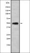 Carbohydrate Sulfotransferase 5 antibody, orb338126, Biorbyt, Western Blot image 