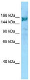 Rho Guanine Nucleotide Exchange Factor 10 antibody, TA338084, Origene, Western Blot image 