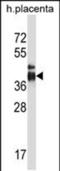 Intelectin 2 antibody, PA5-48624, Invitrogen Antibodies, Western Blot image 