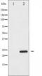 BCL2 Interacting Killer antibody, TA325271, Origene, Western Blot image 