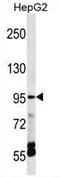 Transient Receptor Potential Cation Channel Subfamily V Member 5 antibody, AP54366PU-N, Origene, Western Blot image 