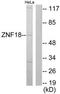 Zinc Finger Protein 18 antibody, TA314686, Origene, Western Blot image 
