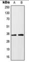 Homeobox protein Hox-A1 antibody, orb360702, Biorbyt, Western Blot image 