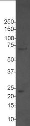 DEAD-Box Helicase 5 antibody, NBP1-30944, Novus Biologicals, Western Blot image 