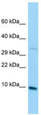 Mitochondrial Ribosomal Protein L36 antibody, TA334329, Origene, Western Blot image 