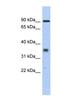 Leucine Rich Repeat Containing 73 antibody, NBP1-56949, Novus Biologicals, Western Blot image 