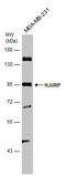 Holliday junction recognition protein antibody, GTX130591, GeneTex, Western Blot image 