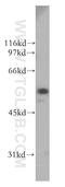 LDM antibody, 13431-1-AP, Proteintech Group, Western Blot image 
