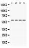 Cell Division Cycle 25C antibody, PB9756, Boster Biological Technology, Western Blot image 