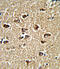 Protein bicaudal C homolog 1 antibody, 62-564, ProSci, Immunohistochemistry paraffin image 