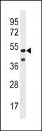 HHV14 UL38 antibody, PA5-72160, Invitrogen Antibodies, Western Blot image 