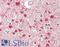 Actinin Alpha 1 antibody, LS-B13855, Lifespan Biosciences, Immunohistochemistry paraffin image 