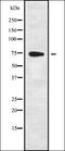 Chromodomain Helicase DNA Binding Protein 8 antibody, orb338179, Biorbyt, Western Blot image 