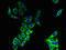 CKLF Like MARVEL Transmembrane Domain Containing 8 antibody, orb34298, Biorbyt, Immunocytochemistry image 