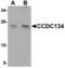 Coiled-coil domain-containing protein 134 antibody, A14619, Boster Biological Technology, Western Blot image 