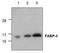 Fatty Acid Binding Protein 5 antibody, TA319094, Origene, Western Blot image 