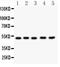 Dopamine Receptor D1 antibody, PB9177, Boster Biological Technology, Western Blot image 