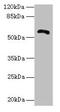 Zinc Finger And BTB Domain Containing 18 antibody, CSB-PA026604LA01HU, Cusabio, Western Blot image 