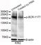 BCR Activator Of RhoGEF And GTPase antibody, STJ29372, St John