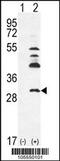 Uridine-Cytidine Kinase 2 antibody, 62-716, ProSci, Western Blot image 