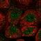Enhancer Of MRNA Decapping 4 antibody, PA5-59461, Invitrogen Antibodies, Immunofluorescence image 