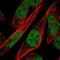 Zinc Finger Protein 594 antibody, NBP2-68883, Novus Biologicals, Immunocytochemistry image 