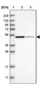 NOP2/Sun RNA Methyltransferase Family Member 7 antibody, NBP1-94011, Novus Biologicals, Western Blot image 