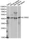 Interleukin 13 Receptor Subunit Alpha 2 antibody, A2043, ABclonal Technology, Western Blot image 