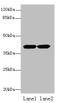 Actin Related Protein T2 antibody, A57998-100, Epigentek, Western Blot image 