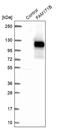Family With Sequence Similarity 171 Member B antibody, NBP1-93846, Novus Biologicals, Western Blot image 