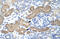 L3MBTL Histone Methyl-Lysine Binding Protein 2 antibody, 27-283, ProSci, Immunohistochemistry paraffin image 