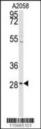 Caveolae Associated Protein 3 antibody, MBS9202588, MyBioSource, Western Blot image 