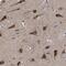 Chromosome 9 Open Reading Frame 135 antibody, PA5-54383, Invitrogen Antibodies, Immunohistochemistry frozen image 