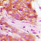 Fibroblast Growth Factor Receptor 1 antibody, LS-C352215, Lifespan Biosciences, Immunohistochemistry paraffin image 