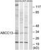 Putative ATP-binding cassette sub-family C member 13 antibody, TA313027, Origene, Western Blot image 