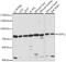 Sphingosine-1-Phosphate Lyase 1 antibody, A04661, Boster Biological Technology, Western Blot image 