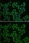 ATK antibody, GTX32479, GeneTex, Immunocytochemistry image 