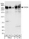 Chromodomain Helicase DNA Binding Protein 4 antibody, A301-082A, Bethyl Labs, Western Blot image 