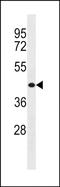 WAS protein family homolog 2 antibody, PA5-49182, Invitrogen Antibodies, Western Blot image 
