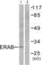 Hydroxysteroid 17-Beta Dehydrogenase 10 antibody, abx013069, Abbexa, Western Blot image 